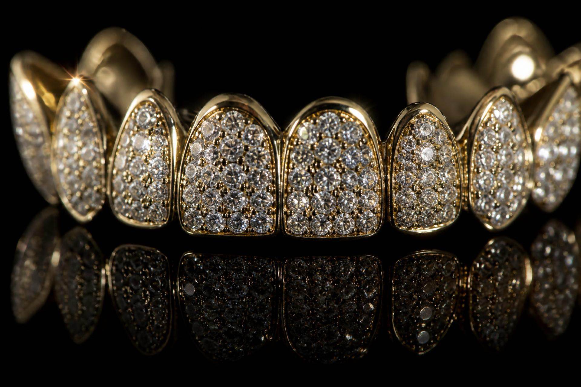 Diamond encrusted custom gold grillz
